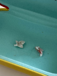 カリたんの乳歯